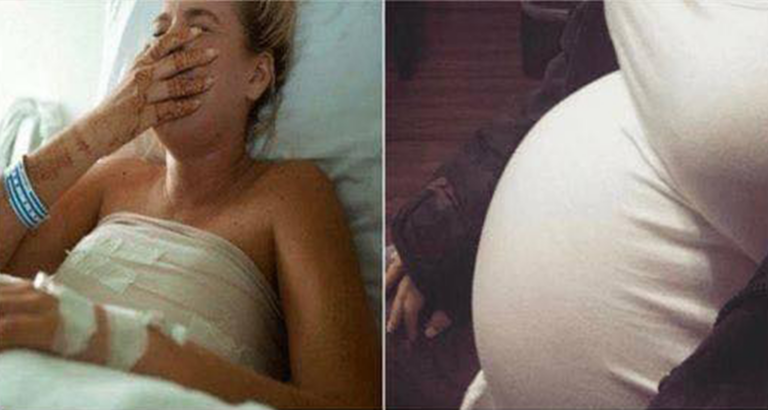 This woman’s pregnancy went normally, until an ultrasound showed her baby had malformations