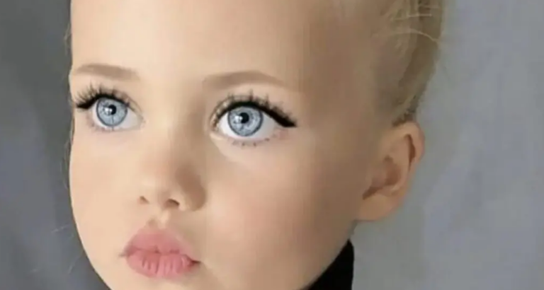 With 4 years, she earned the title ‘the most beautiful girl in the world’ – This is how she looks at 20 years old
