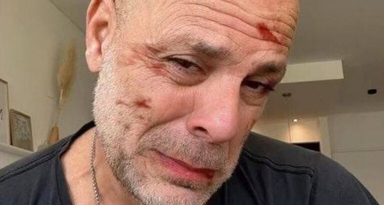 Bruce Willis’ wife Emma Heming shares heartbreaking video of him after his dementia diagnosis