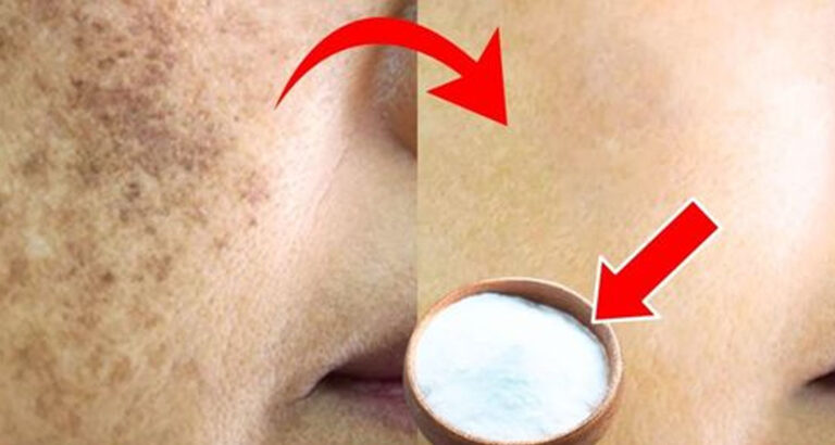 I Erased My Age Spots With a Cheap Kitchen Ingredient — Baking Soda Paste